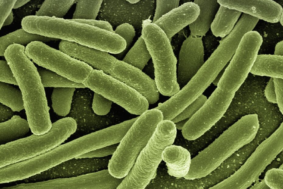 koli bacteria, escherichia coli, bacteria, disease, pathogens, microscopy, electron microscopy, electron microscope, vaccination, immune system, diseases, vaccine, escherichia, infect, infection, risk of infection, pathogen, viruses, bacteria, bacteria, bacteria, bacteria, bacteria